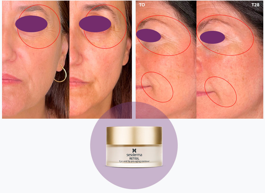 Retisil Ojos y Labios