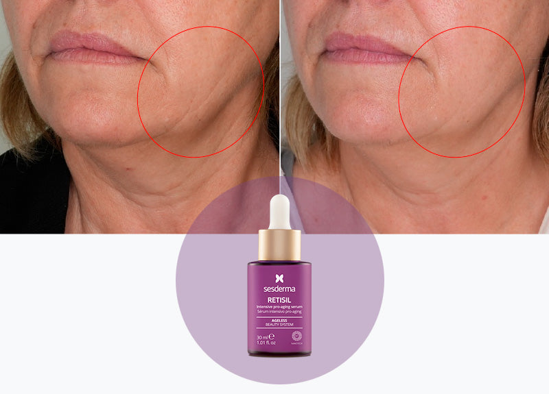 Aceite Intensivo Antiedad con Retinol